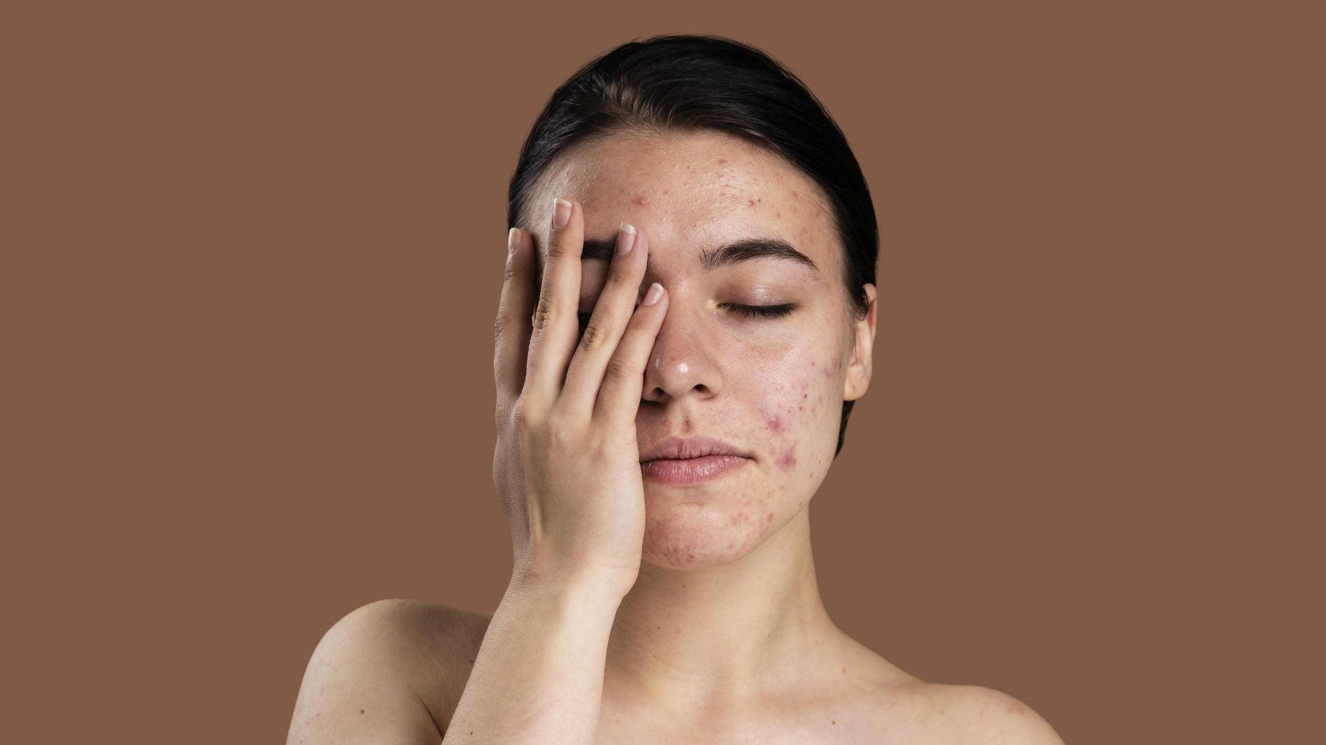 肌肤忽冷忽热，油光粉刺暴走？ 「油水平衡」保养法，让肌肤重回健康稳定！