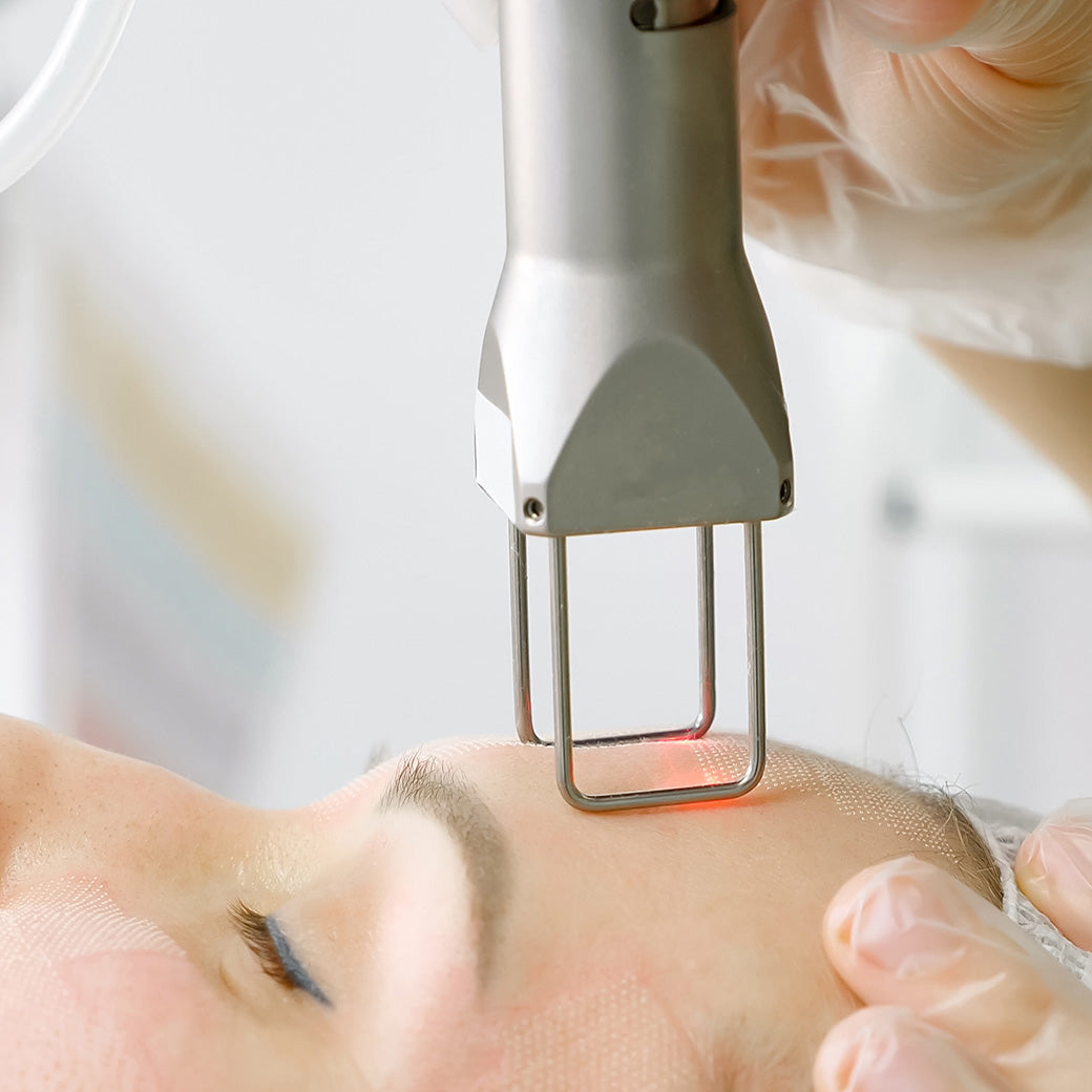 別讓Laser的錢白花！醫美後Home Care快速渡過修復期，效果更持久