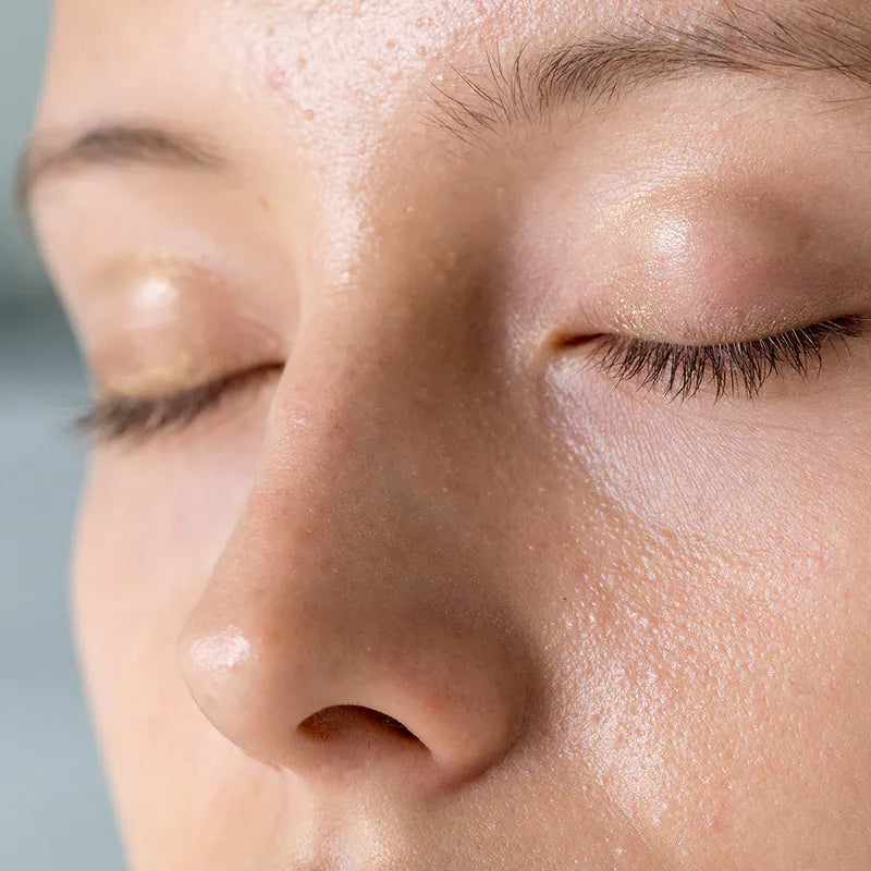 脸上一颗颗凸凸的怎么办？告别内包粉刺，居家焕肤不再烂脸脱皮