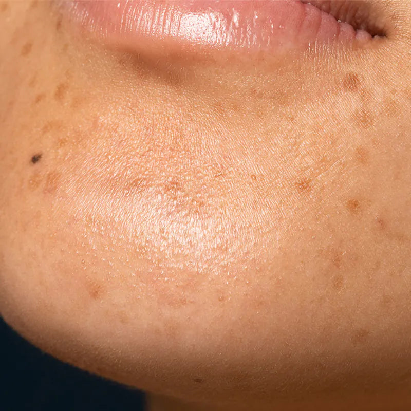 晒后72小时没修护小心「晒后暗沉」？ 5招找回净亮光泽肌