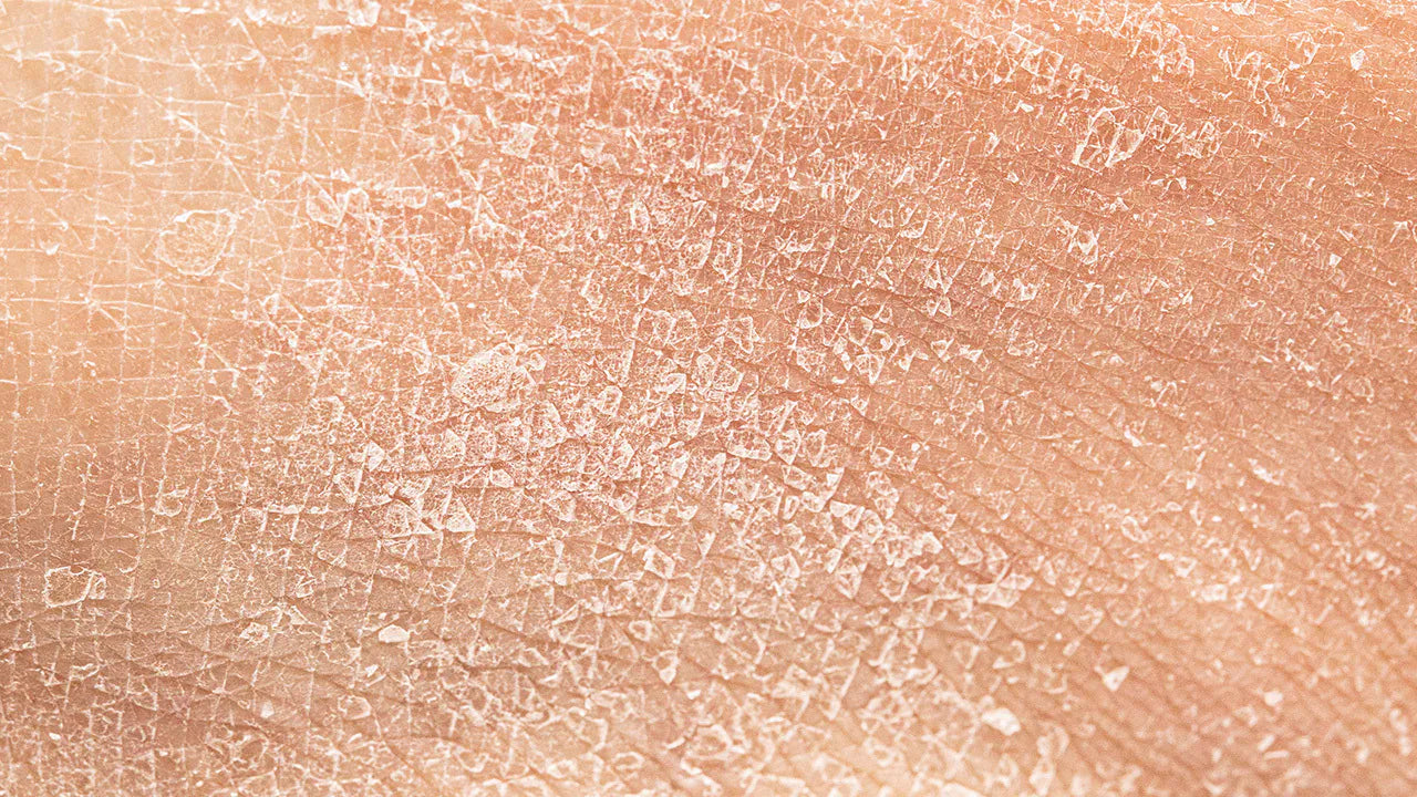 擦完保养品还是干？皮肤缺水4大主因、补水攻略一次看