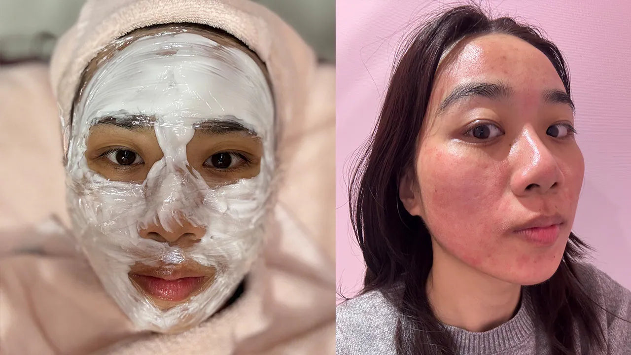 打皮秒打激光后我都用这个来退红保养！｜铁粉开箱