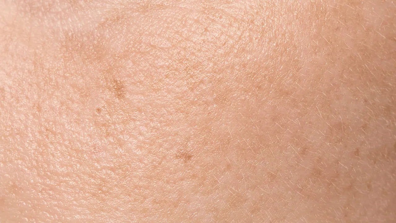 近期肤况大暴走？干痒、出油、粉刺样样来，其实都是「它」出了问题！